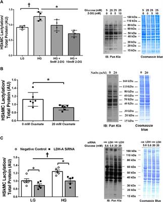 Lactate-induced lactylation in skeletal muscle is associated with insulin resistance in humans